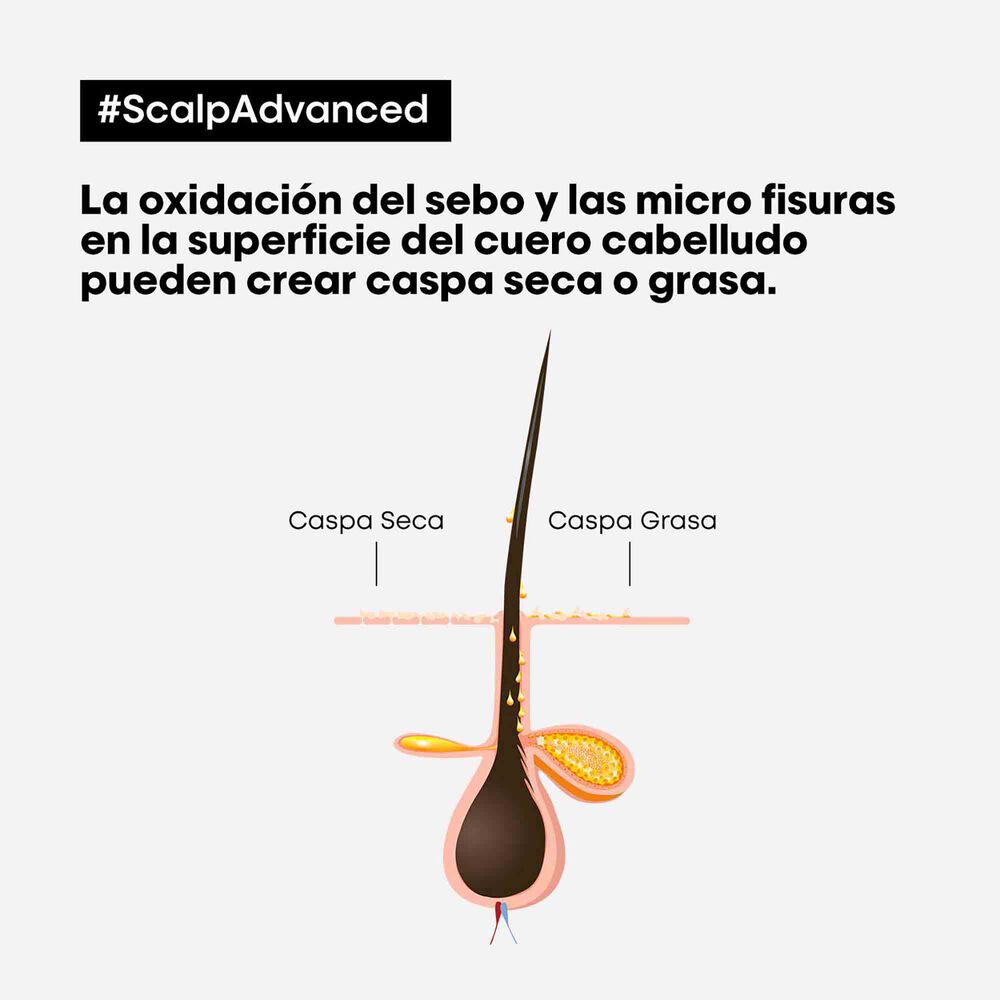 L’Oréal Professionnel Scalp Advanced Shampoo Anticaspa 300 ml