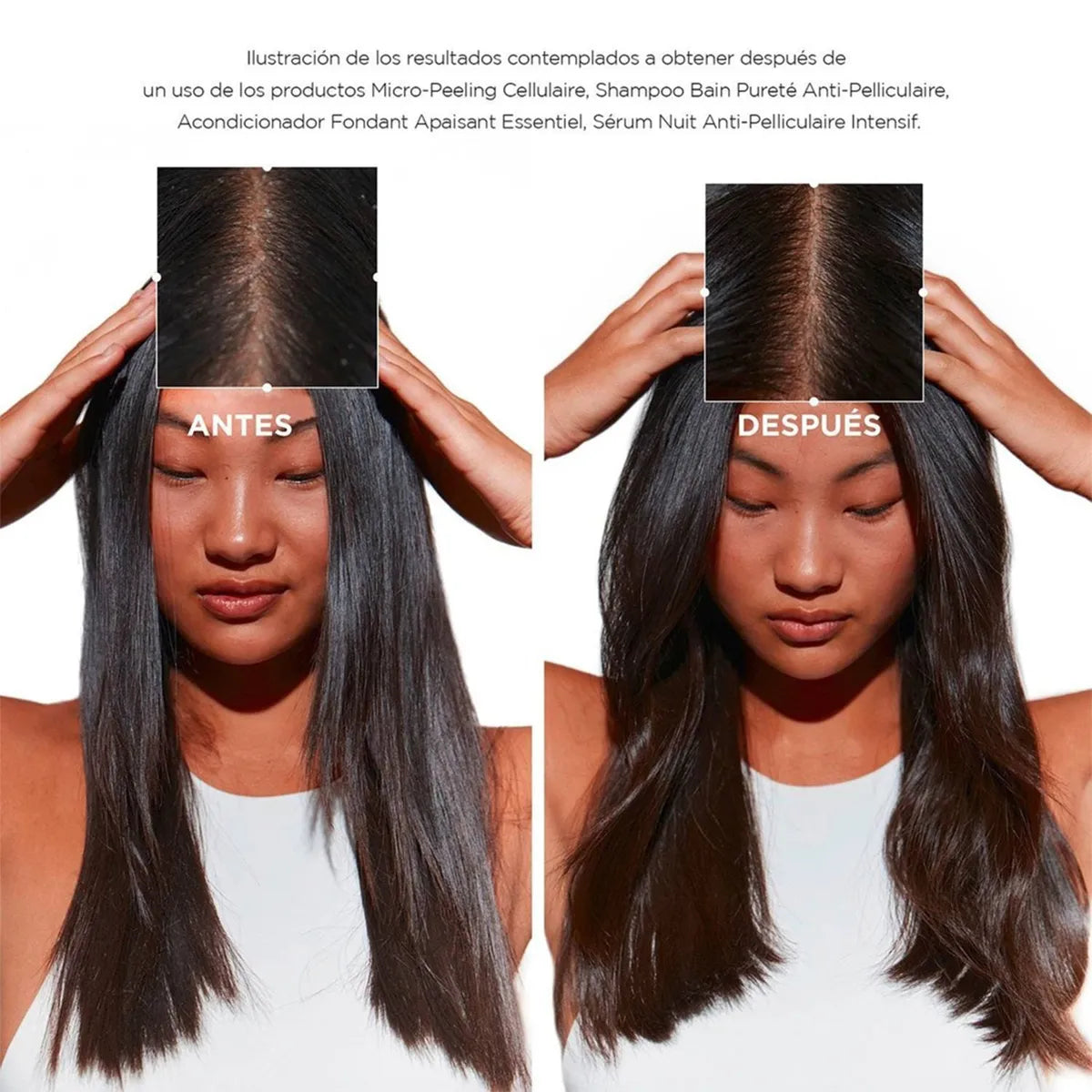 Kérastase Symbiose Bain Pureté Anti-Pelliculaire Shampoo Purificante Anticaspa para Cuero Cabelludo Graso