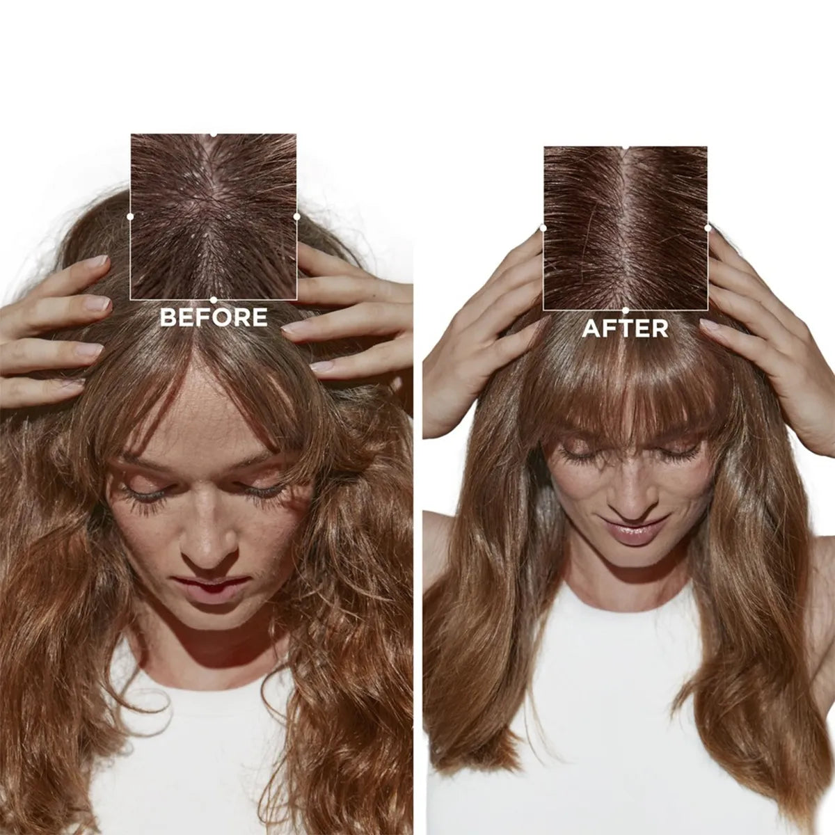 Kérastase Symbiose Masque Revitalisant Essentiel Mascarilla Revitalizante para Cabello con Caspa y Cuero Cabelludo Sensible